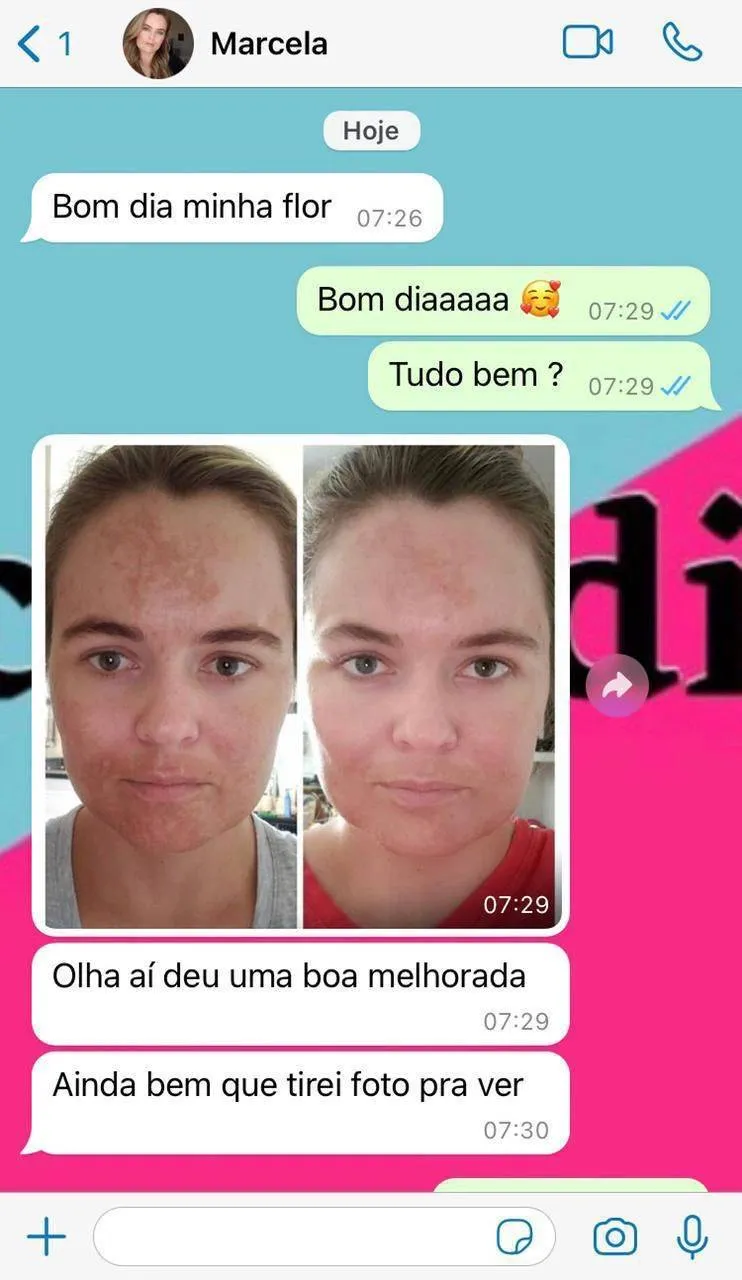 Depoimento real de cliente Amazolé 2