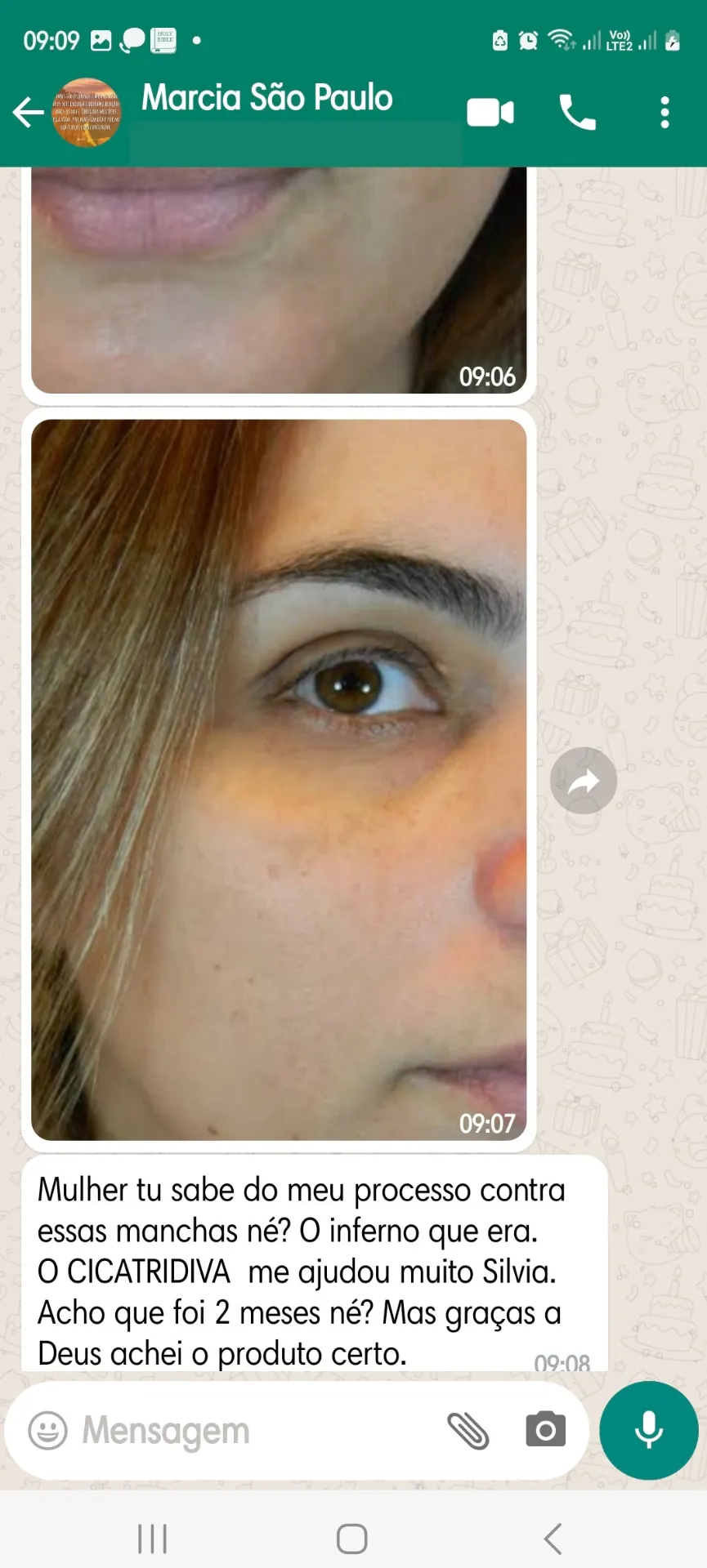 Depoimento real de cliente Amazolé 5
